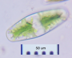 Netrium digitus