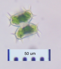 Staurastrum hystrix