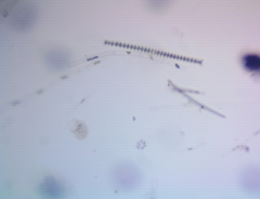 Triploceras gracile