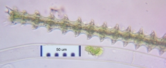 Triploceras gracile