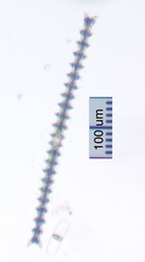 Triploceras gracile