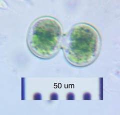 Cosmarium contractum