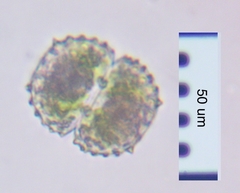 Cosmarium vitiosum vitiosum