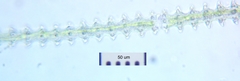 Triploceras gracile