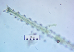 Triploceras gracile