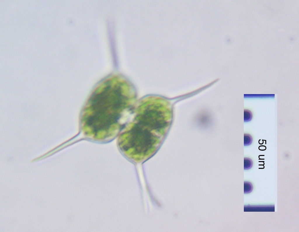 Staurodesmus bulnheimii