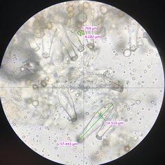 Inocybe margaritispora