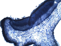 Staurolemma omphalarioides