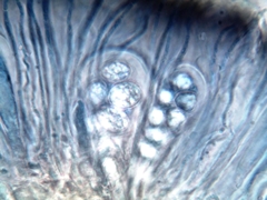 Staurolemma omphalarioides