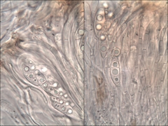 Leptochidium albociliatum