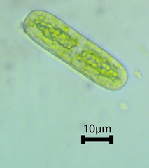 Cylindrocystis