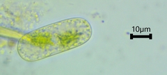 Cylindrocystis