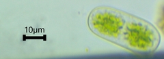 Cylindrocystis