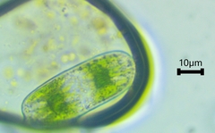 Cylindrocystis