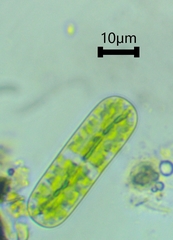 Cylindrocystis