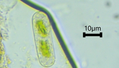 Cylindrocystis