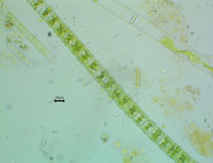 Hyalotheca