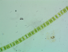 Hyalotheca