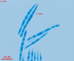Arachnopeziza delicatula