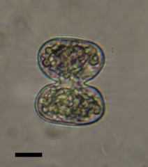 Cosmarium contractum