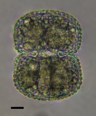 Cosmarium margaritatum