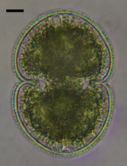 Cosmarium contractum pachydermum