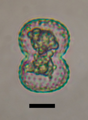 Cosmarium subexcavatum