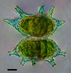 Staurastrum furcigerum