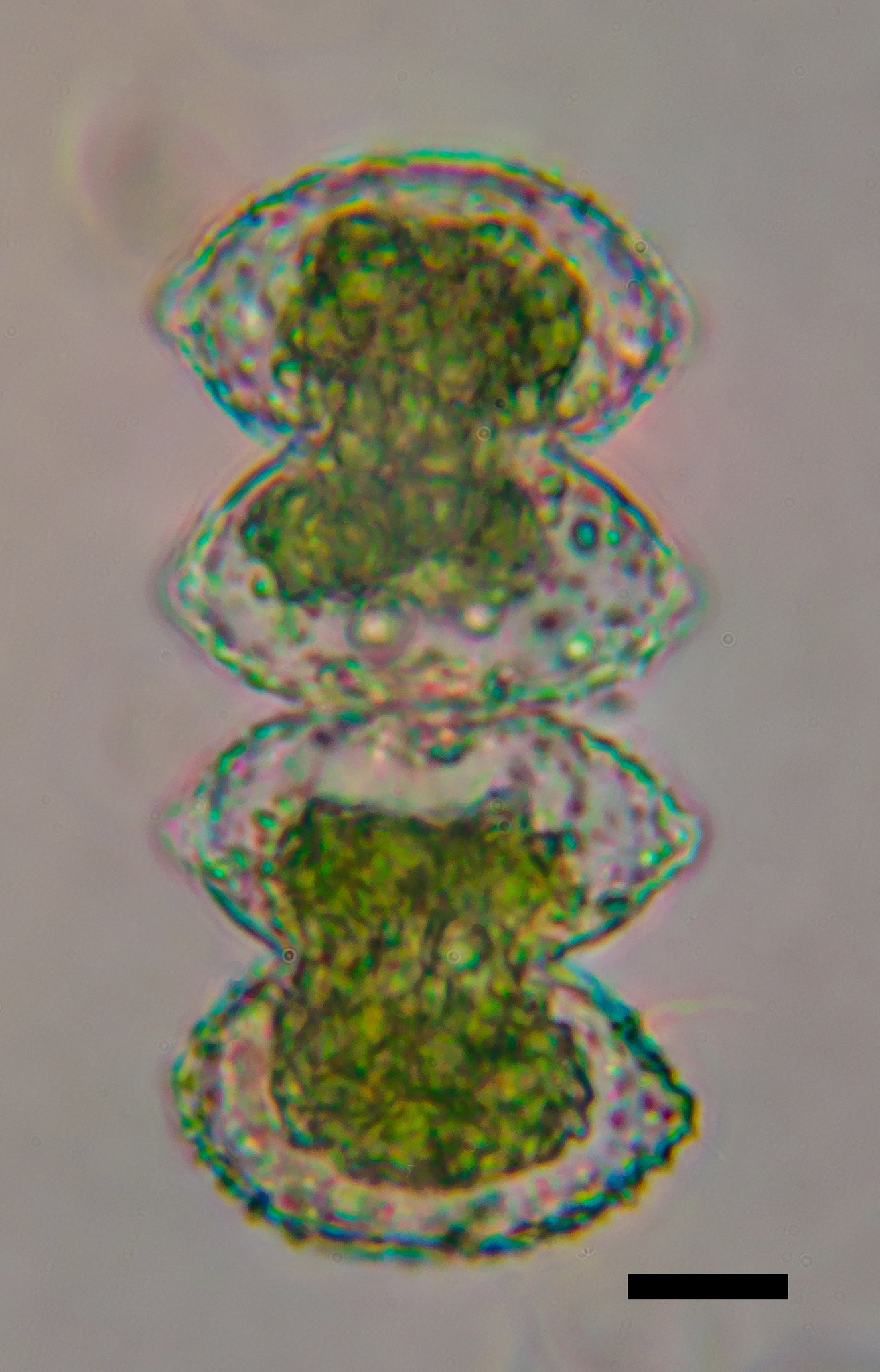 Staurastrum granulosum