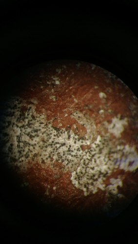 Strigula novae-zelandiae image