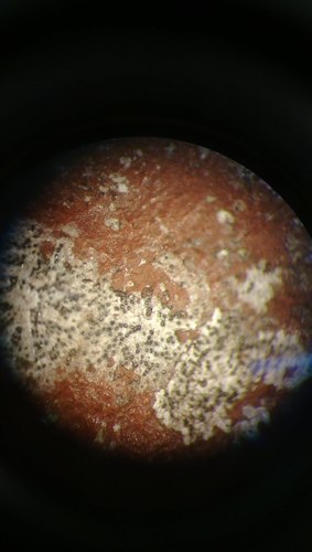 Strigula novae-zelandiae image