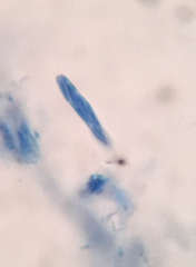 Graphostroma platystomum