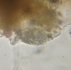 Chilodonellidae