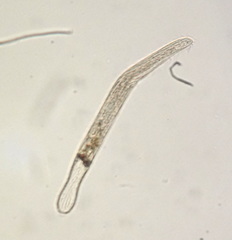 Spirostomum teres