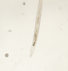 Spirostomum teres
