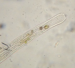 Spirostomum teres