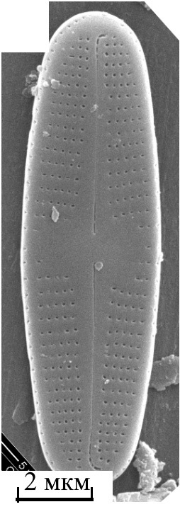 Achnanthidium kranzii