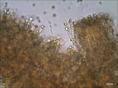 Cantharellus corallinus