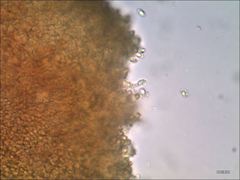 Cantharellus corallinus