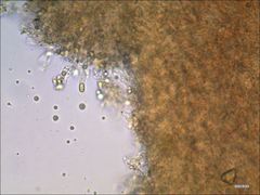 Cantharellus corallinus