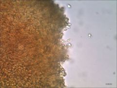 Cantharellus corallinus