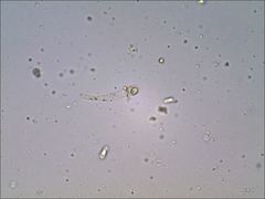 Cantharellus corallinus