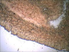 Cantharellus corallinus