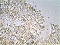 Cantharellus corallinus