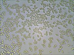 Cantharellus corallinus