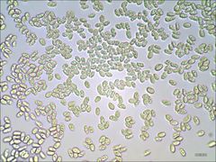 Cantharellus corallinus