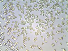 Cantharellus corallinus