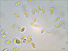 Cantharellus corallinus