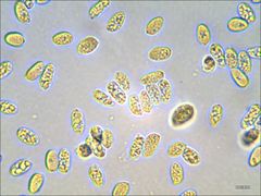 Cantharellus corallinus