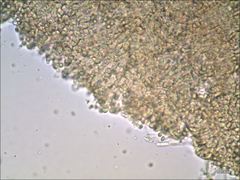 Cantharellus corallinus